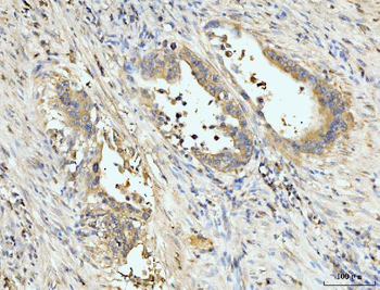 Anti-PDLIM7 Antibody
