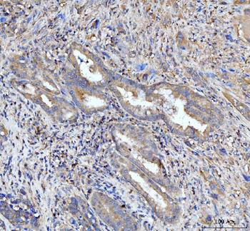 Anti-PDLIM7 Antibody