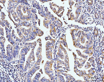 Anti-PDLIM7 Antibody