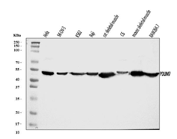 Anti-PDLIM7 Antibody