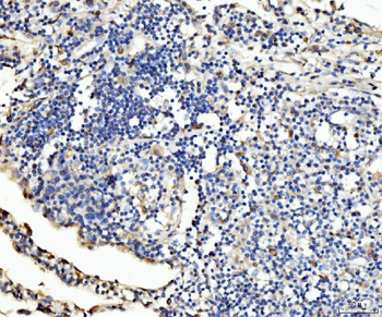 Anti-PLD3 Antibody