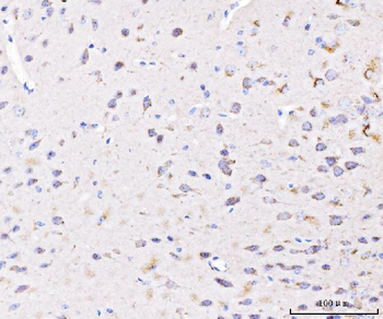 Anti-PLD3 Antibody