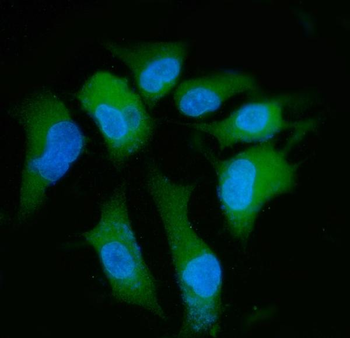 Anti-PPP2R1A Antibody