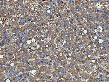 Anti-PPP2R1A Antibody