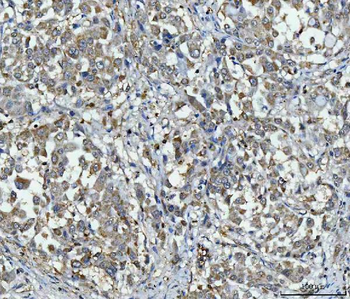 Anti-PPP2R1A Antibody