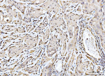 Anti-RAE1 Antibody