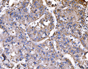 Anti-RAE1 Antibody