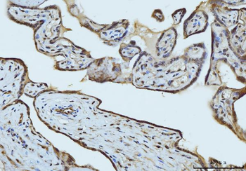 Anti-RAE1 Antibody