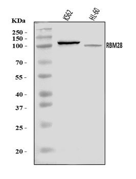 Anti-RBM28 Antibody