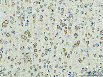 Anti-Rpl9 Antibody