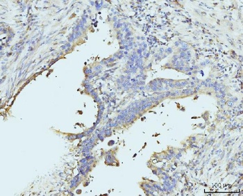 RPL23 Antibody