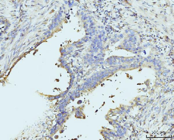 Anti-RPL23 Antibody