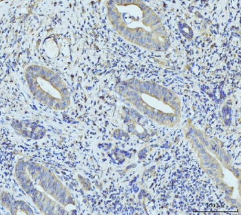 Anti-RPL23 Antibody