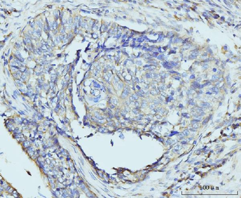 Anti-RPL23 Antibody