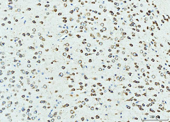 Anti-RPL23 Antibody