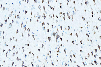Anti-RPL23 Antibody