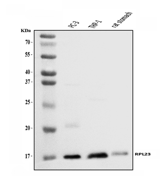 Anti-RPL23 Antibody