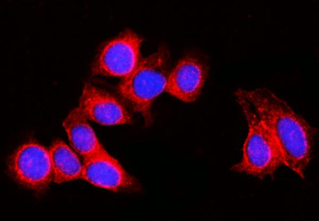 Anti-RPL29 Antibody