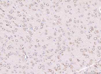 Anti-RPL29 Antibody
