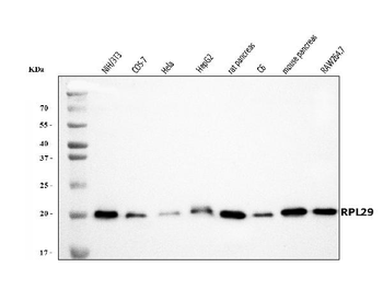 Anti-RPL29 Antibody