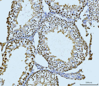 Anti-SBNO1 Antibody
