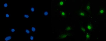 Anti-SBNO1 Antibody