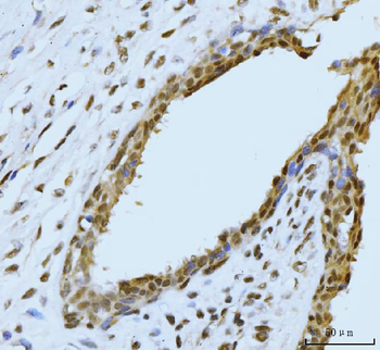 Anti-SBNO1 Antibody