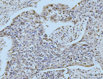Anti-SBNO1 Antibody