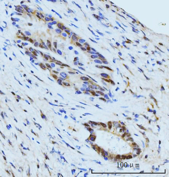 Anti-SBNO1 Antibody