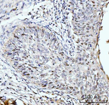 Anti-SBNO1 Antibody