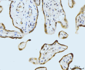 Anti-SBNO1 Antibody