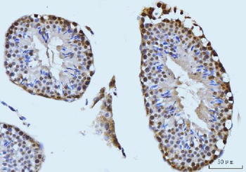 Anti-SBNO1 Antibody