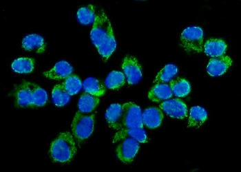 Anti-TARS2 Antibody