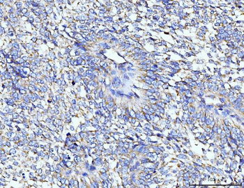 Anti-TARS2 Antibody