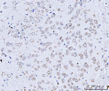 Anti-TARS2 Antibody