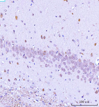 Anti-TARS2 Antibody