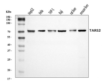 Anti-TARS2 Antibody