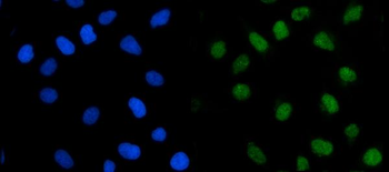 Anti-TRMT1 Antibody