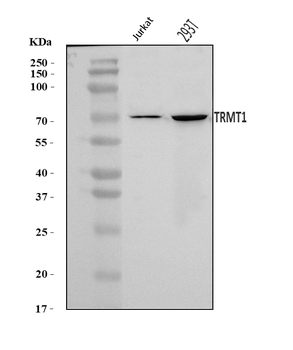 Anti-TRMT1 Antibody