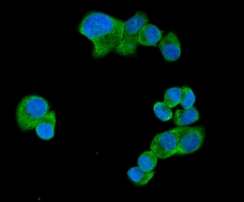 Anti-UBAP2L Antibody