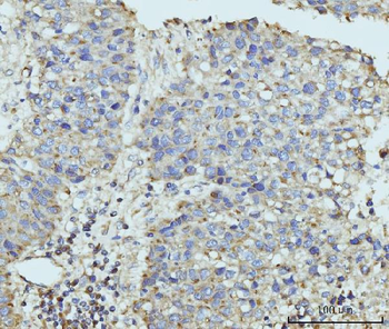 Anti-hUPF2/RENT2/UPF2 Antibody