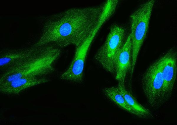 Anti-Filamin B/FLNB Antibody