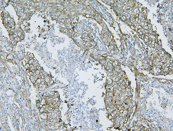 Anti-Filamin B/FLNB Antibody