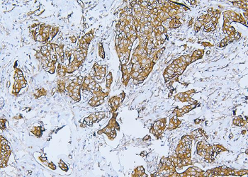 Anti-Filamin B/FLNB Antibody