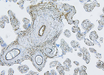 Anti-Filamin B/FLNB Antibody