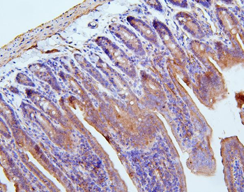 Anti-Filamin B/FLNB Antibody