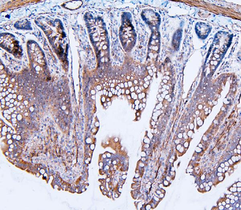Anti-Filamin B/FLNB Antibody