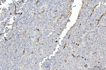 FABP4 Antibody (monoclonal, 10E12)