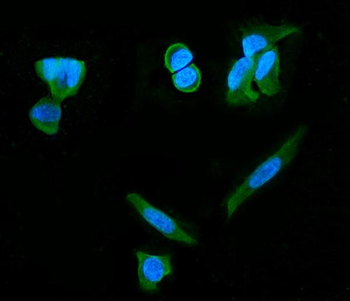 Anti-PDE6 beta/PDE6B Antibody (monoclonal, 8I2F10)
