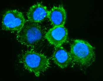 Anti-Moesin/MSN Antibody (monoclonal, 8D4)